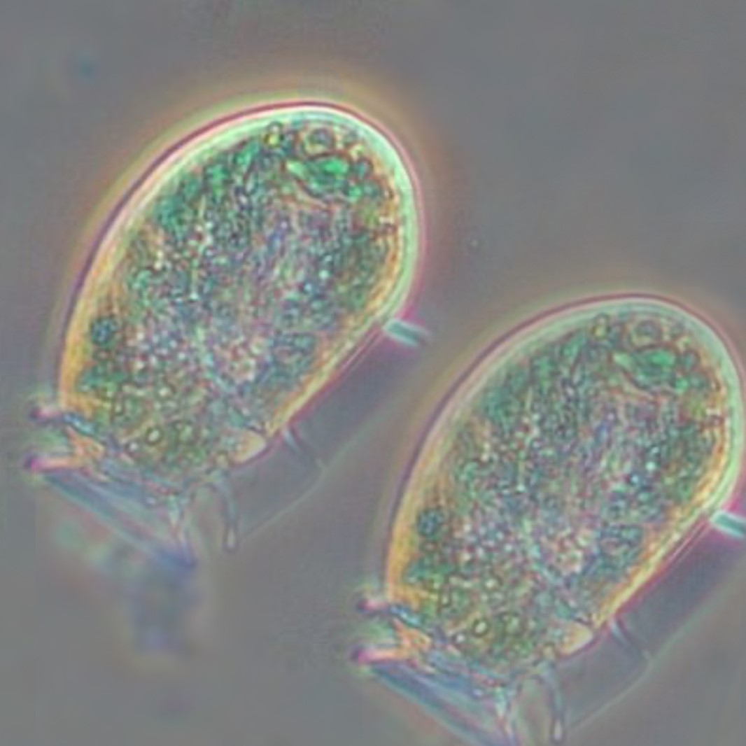 Phycotoxins are toxic substances produced by certain microalgae species, known as phytoplankton. These toxins can contaminate marine organisms like shellfish and fish, which accumulate them by feeding on contaminated phytoplankton. When consumed by humans or other animals, these contaminated marine products pose health risks.
Phycotoxins, such as brevetoxins, okadaic acids, and domoic acids, can cause food poisoning, affecting the nervous and digestive systems, even leading to severe syndromes. Red tides, linked to phytoplankton proliferations, are often associated with these toxins. Environmental conditions, like temperature and nutrients, favor these red tides. Monitoring phycotoxins in fishing areas, along with warnings and temporary bans during high concentrations, are crucial measures to minimize health risks associated with these marine toxins.